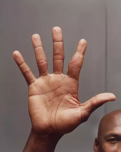 NBA5大有身体缺陷的球员，姚明听力丧失60%，1人少一根手指！(4)