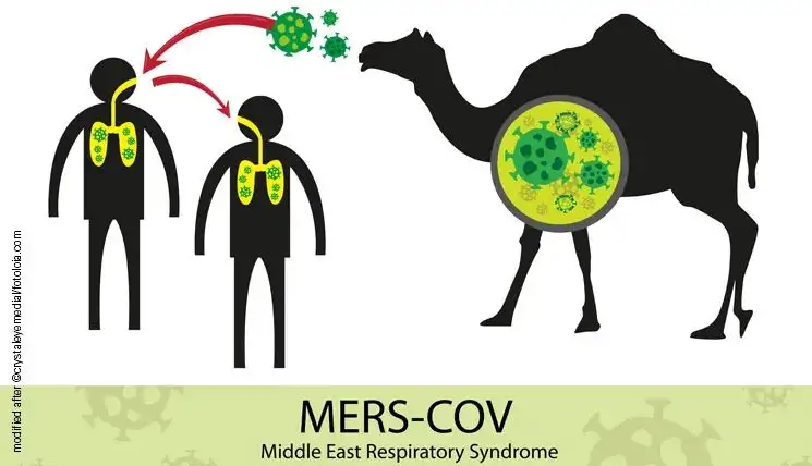 法国队夺冠遭遇最大障碍骆驼流感，这是一种比新冠还可怕的病毒
